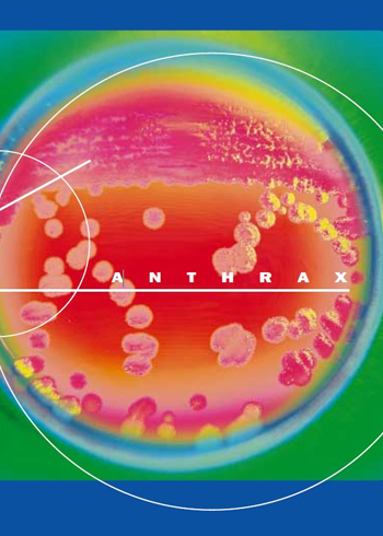 2001. Rapid test to diagnose anthrax