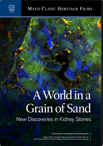 World in a grain of sand